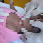 Bebê de 2 meses tem pescoço cortado pela própria mãe, que diz ter ouvido vozes mandando matá-la