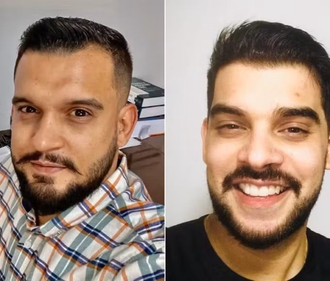 Polícia investiga se reprovações acadêmicas motivaram ataque a tiros contra professora em Gurupi
